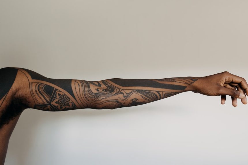 Czy laserowe usuwanie tatuaży jest bezpieczne?